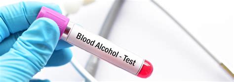 do you have to drop for alcohol test|blood alcohol testing requirements.